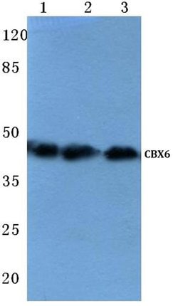 CBX6 Polyclonal Antibody:Antibodies, Polyclonal