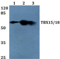 Invitrogen TBX15/TBX18 Polyclonal Antibody 100 &mu;L | Buy Online | Invitrogen&trade; | Fisher Scientific