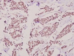 Invitrogen HKR1 Polyclonal Antibody 100 &mu;L; Unconjugated:Antibodies,