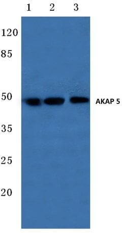 Invitrogen AKAP5 Polyclonal Antibody 100 μL; Unconjugated:Antibodies,