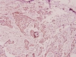 Invitrogen PTX3 Polyclonal Antibody 100 &mu;L; Unconjugated:Antibodies,