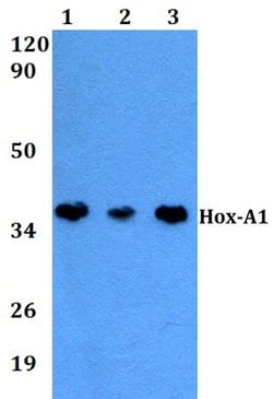 Invitrogen HOXA1 Polyclonal Antibody 100 &mu;L; Unconjugated:Antibodies,