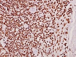 Invitrogen CLK2 Polyclonal Antibody 100 &mu;L; Unconjugated:Antibodies,