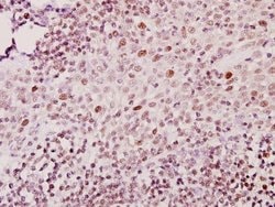 Invitrogen ZNF75D Polyclonal Antibody 100 &mu;L; Unconjugated:Antibodies,