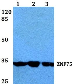 Invitrogen ZNF75D Polyclonal Antibody 100 &mu;L; Unconjugated:Antibodies,