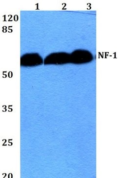 NFI Polyclonal Antibody, Invitrogen 100 &mu;L; Unconjugated:Antibodies,