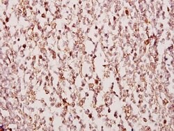 TUSC3 Polyclonal Antibody:Anticuerpos