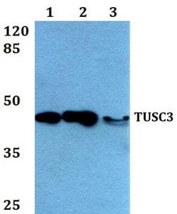 TUSC3 Polyclonal Antibody:Anticuerpos