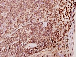 Invitrogen TDE1 Polyclonal Antibody 100 &mu;L; Unconjugated:Antibodies,