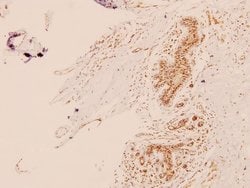 Invitrogen TRAP220 Polyclonal Antibody 100 &mu;L; Unconjugated:Antibodies,