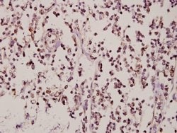 Invitrogen ZNF174 Polyclonal Antibody 100 &mu;L; Unconjugated:Antibodies,