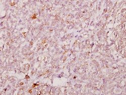 Invitrogen FOXJ1 Polyclonal Antibody 100 &mu;L; Unconjugated:Antibodies,