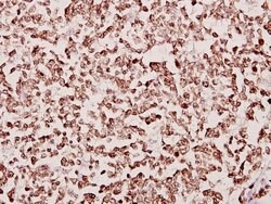 Invitrogen TAF6L Polyclonal Antibody 100 &mu;L; Unconjugated:Antibodies,