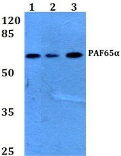 Invitrogen TAF6L Polyclonal Antibody 100 &mu;L; Unconjugated:Antibodies,