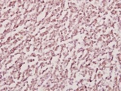 Invitrogen H-cadherin Polyclonal Antibody 100 &mu;L; Unconjugated:Antibodies,