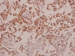 Invitrogen CDH18 Polyclonal Antibody 100 &mu;L; Unconjugated:Antibodies,