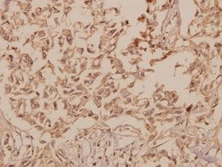 Invitrogen hnRNP H2 Polyclonal Antibody 100 &mu;L | Buy Online | Invitrogen&trade; | Fisher Scientific