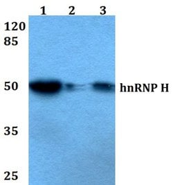 Invitrogen hnRNP H2 Polyclonal Antibody 100 &mu;L | Buy Online | Invitrogen&trade; | Fisher Scientific