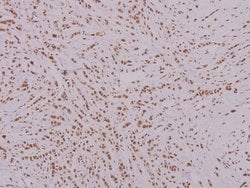 Invitrogen FOXK1 Polyclonal Antibody 100 &mu;L; Unconjugated:Antibodies,