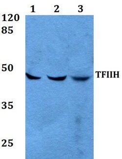 GTF2H2 Polyclonal Antibody:Antibodies, Polyclonal