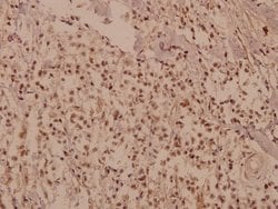 Invitrogen CUG-BP Polyclonal Antibody 100 &mu;L; Unconjugated:Antibodies,
