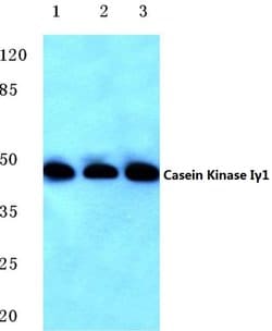 Invitrogen CK1 gamma-1 Polyclonal Antibody 100 &mu;L; Unconjugated:Antibodies,