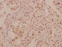 Invitrogen MRCK beta Polyclonal Antibody 100 &mu;L; Unconjugated:Antibodies,