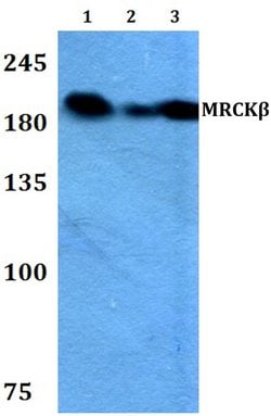 Invitrogen MRCK beta Polyclonal Antibody 100 &mu;L; Unconjugated:Antibodies,