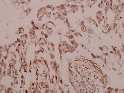 Invitrogen SIAH2 Polyclonal Antibody 100 &mu;L; Unconjugated:Antibodies,