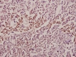 Invitrogen MID1 Polyclonal Antibody 100 &mu;L; Unconjugated:Antibodies,