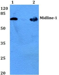 Invitrogen MID1 Polyclonal Antibody 100 &mu;L; Unconjugated:Antibodies,