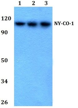 Invitrogen NEMF Polyclonal Antibody 100 &mu;L; Unconjugated:Antikroppar