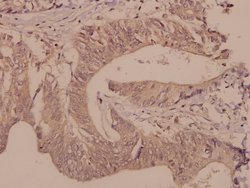 Invitrogen DGKQ Polyclonal Antibody 100 &mu;L | Buy Online | Invitrogen&trade; | Fisher Scientific