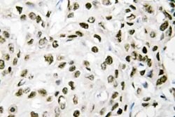 Invitrogen VPS72 Polyclonal Antibody 100 &mu;L; Unconjugated:Antibodies,