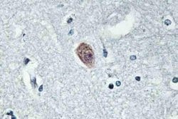 Invitrogen DOK6 Polyclonal Antibody 100 &mu;L; Unconjugated:Antibodies,