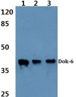 Invitrogen DOK6 Polyclonal Antibody 100 &mu;L; Unconjugated:Antibodies,