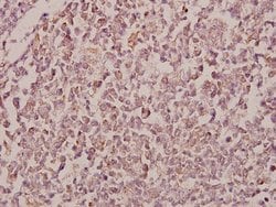 Invitrogen RhoBTB1/RhoBTB2 Polyclonal Antibody 100 &mu;L; Unconjugated:Antibodies,