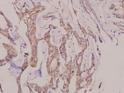 Invitrogen AKAP13 Polyclonal Antibody 100 &mu;L | Buy Online | Invitrogen&trade; | Fisher Scientific