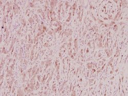 Invitrogen ZNF23 Polyclonal Antibody 100 &mu;L; Unconjugated:Antibodies,