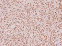 Invitrogen HOXD12 Polyclonal Antibody 100 &mu;L; Unconjugated:Antibodies,