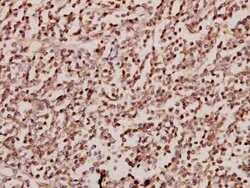 Invitrogen SRSF4 Polyclonal Antibody 100 μL; Unconjugated:Antibodies,
