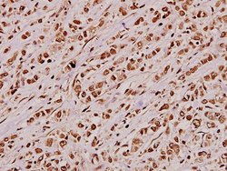 Invitrogen JIP3 Polyclonal Antibody 100 &mu;L; Unconjugated:Antibodies,