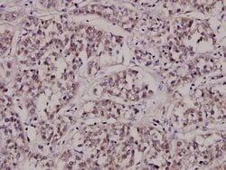 Invitrogen CTPS Polyclonal Antibody 100 &mu;L; Unconjugated:Antibodies,