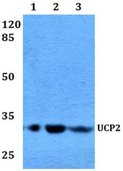 Invitrogen UCP2 Polyclonal Antibody 100 &mu;L; Unconjugated:Antibodies,
