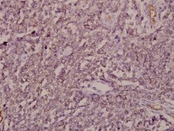 Invitrogen ARF4 Polyclonal Antibody 100 &mu;L; Unconjugated:Antibodies,