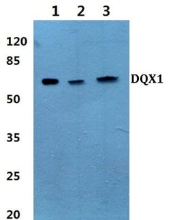 Invitrogen DQX1 Polyclonal Antibody 100 &mu;L; Unconjugated:Antibodies,
