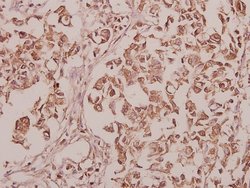 Invitrogen CEP135 Polyclonal Antibody 100 &mu;L; Unconjugated:Antibodies,