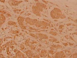 Invitrogen Cerebral Protein 1 Polyclonal Antibody 100 &mu;L; Unconjugated:Antibodies,