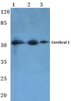 Invitrogen Cerebral Protein 1 Polyclonal Antibody 100 &mu;L; Unconjugated:Antibodies,