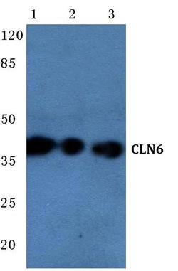 CLN6 Polyclonal Antibody, Invitrogen 100 &mu;L | Buy Online | Invitrogen | Fisher Scientific